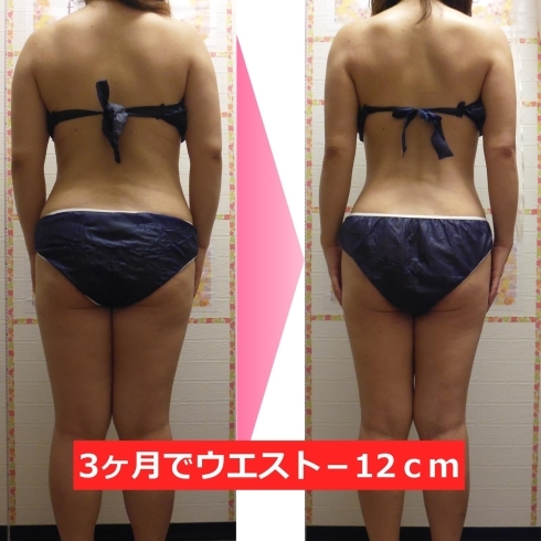 ダイエット1ヶ月間で7キロ痩せた 米子市上福原でダイエットを13年間行っている整体 美容サロン フェールラヴィ 骨盤矯正ダイエット キャビテーション デトックスリンパ 痩身整体 小顔矯正 Faire Ravie フェールラヴィ のニュース まいぷれ 米子 ダイエット1ヶ月間で7キロ痩せた 米子市上福原でダイエットを13年間行っている整体 美容サロン フェールラヴィ 骨盤矯正ダイエット キャビテーション デトックスリンパ 痩身整体 小顔矯正 Faire Ravie フェールラヴィ のニュース まいぷれ 米子