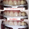 メディカルホワイトニング「メディカルホワイトニング」