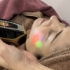 ミニフェイシャル