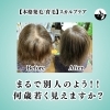 本格発毛育毛スカルプケア横浜市「8回の施術でここまで変わる!?後ろ姿に自信が持てる美髪へ!」