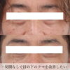 「このような方におすすめ！韓国トリプルハイフ【福井ハイフ/福井エステ/福井フェイシャルエステ/福井小顔】」