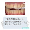 before「メディカルホワイトニング」