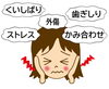 顎の痛みと違和感にも対応する鍼灸「頭痛、鍼灸で解決できる」