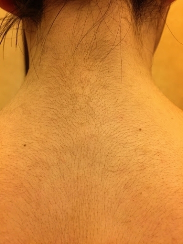 新居浜市で実力実績no 1の凄腕 美容脱毛専門店ローランパリス 西の土居店が誕生 新居浜で本格的な最高級脱毛機器ルミクスa9入荷 男女スタッフ在籍 さらに 女性 男性 キッズの全身脱毛に対応 凄腕整体 美容脱毛専門店ローランパリス 西の土居店の 新居浜市で実力実績no 1の凄腕 美容脱毛専門店ローランパリス 西の土居店が誕生 新居浜で本格的な最高級脱毛機器ルミクスa9入荷 男女スタッフ在籍 さらに 女性 男性 キッズの全身脱毛に対応 凄腕整体 美容脱毛専門店ローランパリス 西の土居店の