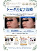 「美容医療がはじめての方へ✨開院キャンペーン「トータルピコ」のご案内📄」