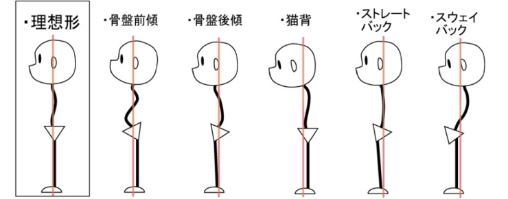 皆さんの姿勢はどれですか？「ご自分の「姿勢」を意識した事はございますか？　ちょっとした事を意識をするだけでも姿勢は改善されます。それ以上の「美」を求めるならばKiitos川口にお任せください。」