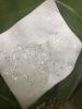 ヒゲ脱毛「爆抜けヒゲ脱毛☆毎日の保湿で効果もUP◎」
