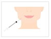 「歯医者で美しくなろう　#ボツリヌス療法#ヒアルロン酸療法#ボトックス#ヒアルロン酸#筋肉#しわ#くいしばり#はぎしり#ほうれい線」