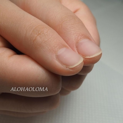 深爪 噛み癖 男爪等 コンプレックス爪 トラブル爪のお悩みに対応 福井市 ネイルサロン Nail Melia Medical Healthcare のニュース まいぷれ 福井 深爪 噛み癖 男爪等 コンプレックス爪 トラブル爪のお悩みに対応 福井市 ネイルサロン Nail Melia Medical Healthcare のニュース まいぷれ 福井