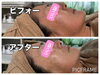 頬までしっかりリフトアップ！くすみもなくなり明るい肌へ「すぐわかる実感もながーく続く実感も両方味わえるダクトピール」