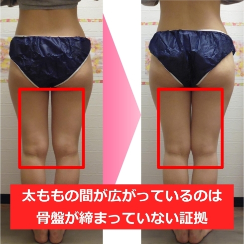 ダイエット1ヶ月間で7キロ痩せた 米子市上福原でダイエットを13年間行っている整体 美容サロン フェールラヴィ 骨盤矯正ダイエット キャビテーション デトックスリンパ 痩身整体 小顔矯正 Faire Ravie フェールラヴィ のニュース まいぷれ 米子 ダイエット1ヶ月間で7キロ痩せた 米子市上福原でダイエットを13年間行っている整体 美容サロン フェールラヴィ 骨盤矯正ダイエット キャビテーション デトックスリンパ 痩身整体 小顔矯正 Faire Ravie フェールラヴィ のニュース まいぷれ 米子