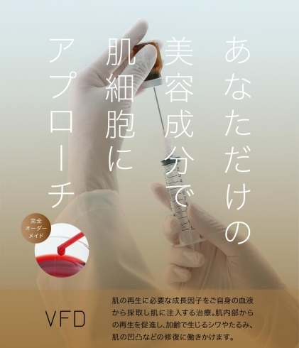 VFD療法 広告「オススメのエイジングケア🎶 長崎県初導入のVFD療法であなただけの美容成分を　再生医療　佐世保　佐々」