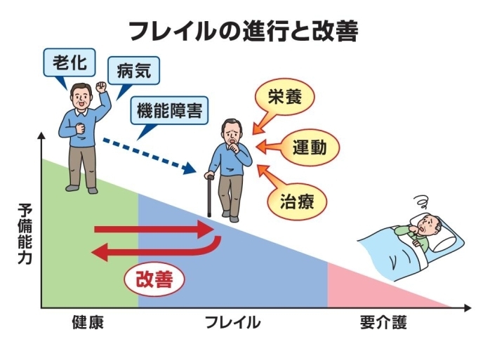 「フレイル」予防の為には運動と食事はマストです。「加齢と歩行能力の変化　その１」