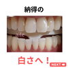 メディカルホワイトニング「お客様ご紹介」