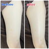 「【キラ肌痩身】before  after✨️✨️」