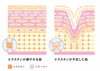 「【ヒト臍帯幹細胞上清液×高純度エラスチン】Litとは？」