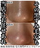 施術前後の写真「様々な化粧品を使っても解消されなかった頑固な毛穴のお悩みは毛穴プロにおまかせ」