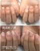 短指症 マムシ指 でも自爪育成 福井市 ネイルサロン コンプレックス Nail Melia Medical Healthcare のニュース まいぷれ 福井 短指症 マムシ指 でも自爪育成 福井市 ネイルサロン コンプレックス Nail Melia Medical Healthcare のニュース まいぷれ 福井