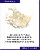 使わなくなった金歯（金パラ）を買取しました ｜市川市・本八幡で金歯