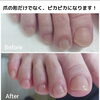 「足爪ぴかぴかネイルケアで癒しの70分間を体験しませんか？」
