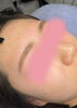 施術イメージ（女性）※効果は個人差があります。「＜眉毛から変わる！＞夏本番に向けて「ハリウッドブロウリフト」で爽やかイメージアップ✨【西条市のエステサロンBEAUTY SALON coco komii（コココミィ）】」
