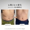 【【３ヶ月集中】】(男性)チネイザン5回セット 