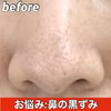 「✴︎エステbefore・after✴︎」