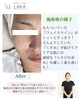 「1回で変わる顔、12回で変わる横顔＊首から整えるソニックエステ」