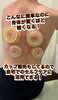 身体が軽くなる！カッピングで驚きの体験「みずほ整骨院のカッピングは一味違う！」