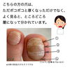 爪が5層⁈「トラブル爪のフットネイルケア②」