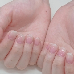 深爪矯正・育成コース（3ヵ月～半年程度の継続が必要です）