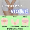 「夏のムレが嫌！VIO脱毛」
