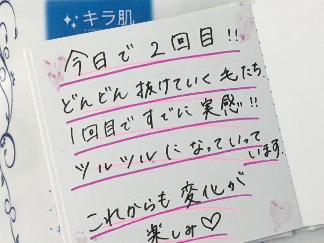 松江在住「口コミ」全身脱毛2回目。「【口コミ】松江市22歳M.A様。予約も取りやすくオススメ」