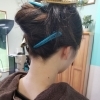 女性脱毛