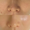BeforeAfter「セラピールの効果★」