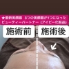ハリツヤVIPエステ(40分)