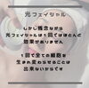 「光フォトフェイシャルって何にいいの？」