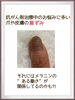 「【アピアランスケア】がん治療とメラニンの関係」