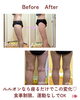 BeforeAfter「セルライトの原因は？」