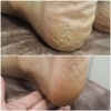 つるすべ！ふわふわ！足うら角質除去(約60分)