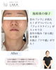 「首元が変わればお肌も変わる＊首から整えるソニックエステ」