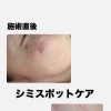 【シミスポットケア】うれしいご報告❣️
