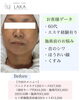 「60代のお客様の施術変化＊首元からのケアでお顔もふっくら、明るい艶肌へ」