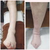 フットリフレのBefore・After「足が蒸れちゃうこの時期だから!!裸足になる時期だから!!足のケアしませんか？大阪駅・梅田駅から2駅にある足トラブルに特化したフットケアサロン👣野田阪神からすぐ‼️」