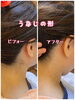 うなじの形を綺麗に整えます！ before/after「美容の積み上げ」