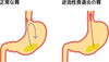 背骨矯正と内臓マニピュレーションが効果的「逆流性食道炎、胸やけの改善に☆初回4800円☆」