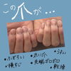 「自爪で美爪になる方法...♥【福井市 / ネイルサロン / メディカルネイルプランナー】」