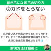 巻き爪になる爪の切り方②「巻き爪を予防！正しい爪の切り方【外反母趾や巻き爪、足の悩み専門整体/千葉県船橋市西船徒歩2分】」