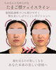 「エラはりは遺伝じゃない🧬 【新潟/村上市の小顔整体/小顔矯正/全身の歪みを整え戻りの少ない美小顔へ/姿勢改善/自律神経/整顔】」