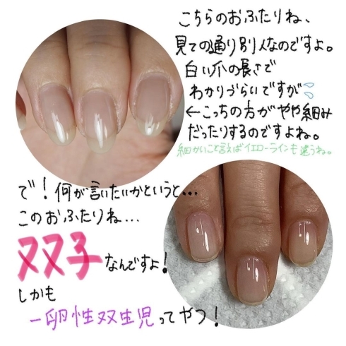 自爪育成 人と比べず自分のペースで 福井市 ネイルサロン メディカルネイルプランナー Nail Melia Medical Healthcare のニュース まいぷれ 福井 自爪育成 人と比べず自分のペースで 福井市 ネイルサロン メディカルネイルプランナー Nail Melia Medical Healthcare のニュース まいぷれ 福井